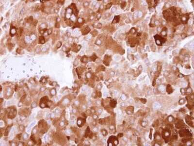 Immunohistochemistry-Paraffin: Latent TGF-beta bp4 Antibody [NBP2-43671] - Analysis of Adrenal Gland Tumor. LTBP4 antibody [N1N2], N-term dilution: 1:250.