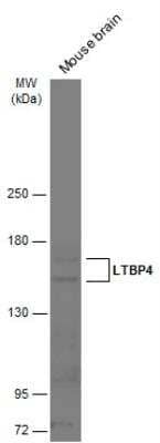 Western Blot: Latent TGF-beta bp4 Antibody [NBP2-43671] - Mouse tissue extract (50 ug) was separated by 5% SDS-PAGE, and the membrane was blotted with LTBP4 antibody [N1N2], N-term  diluted at 1:500. The HRP-conjugated anti-rabbit IgG antibody (NBP2-19301) was used to detect the primary antibody.