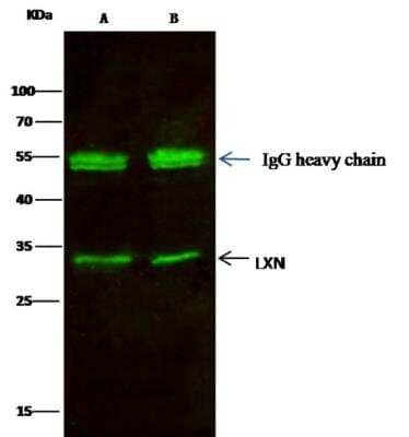 Immunoprecipitation: Latexin Antibody (101) [NBP2-89341] - Lane A:0.5 mg A549 Whole Cell Lysate Lane B:0.5 mg Hela Whole Cell Lysate2 uL anti-LXN rabbit monoclonal antibody and 15 ul of 50 % Protein G agarose.Primary antibody: Anti-LXN rabbit monoclonal antibody,at 1:200 dilution Secondary antibody: Dylight 800-labeled antibody to rabbit IgG (H+L), at 1:5000 dilution Developed using the odssey technique.  Performed under reducing conditions. Predicted band size: 25.7 kDa Observed band size: 25.7 kDa