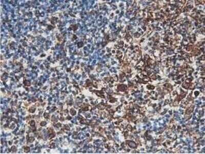 Immunohistochemistry: Latexin Antibody (OTI1E10) - Azide and BSA Free [NBP2-72069] - Staining of paraffin-embedded Human lymphoma tissue using anti-LXN mouse monoclonal antibody.