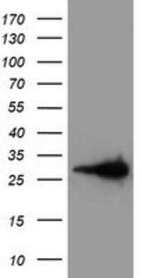 Western Blot: Latexin Antibody (OTI1E10) - Azide and BSA Free [NBP2-72069] - HEK293T cells were transfected with the pCMV6-ENTRY control (Left lane) or pCMV6-ENTRY LXN (Right lane) cDNA for 48 hrs and lysed. Equivalent amounts of cell lysates (5 ug per lane) were separated by SDS-PAGE and immunoblotted with anti-LXN.