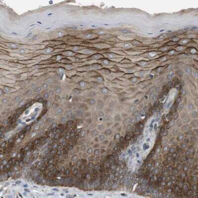 Immunohistochemistry-Paraffin: Latrophilin 3/LPHN3 Antibody [NBP1-82962] - Staining of human cervix, uterine shows moderate to strong membranous and cytoplasmic positivity in squamous epithelial cells.