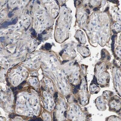 Immunohistochemistry-Paraffin: Latrophilin 3/LPHN3 Antibody [NBP1-82962] - Staining of human placenta shows moderate membranous positivity in trophoblastic cells.