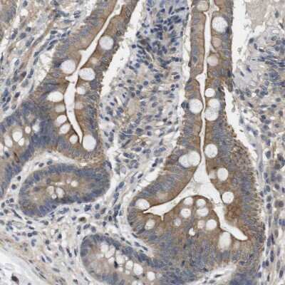 Immunohistochemistry-Paraffin: Latrophilin 3/LPHN3 Antibody [NBP1-82962] - Staining of human small intestine shows moderate membranous positivity in glandular cells.