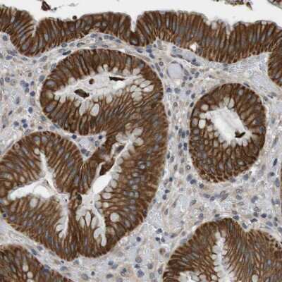 Immunohistochemistry-Paraffin: Latrophilin 3/LPHN3 Antibody [NBP1-82962] - Staining of human stomach shows strong membranous and cytoplasmic positivity in glandular cells.