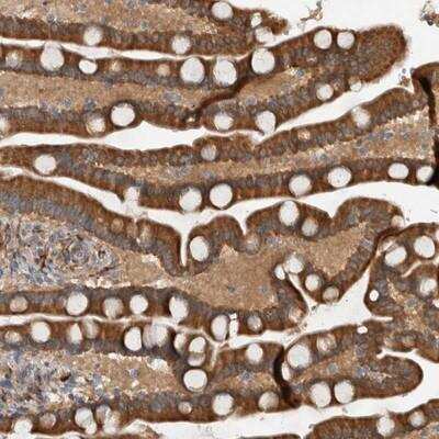 Immunohistochemistry-Paraffin: Latrophilin 3/LPHN3 Antibody [NBP1-82963] - Staining of human duodenum shows strong cytoplasmic positivity in glandular cells.