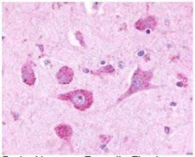 Immunohistochemistry-Paraffin: Latrophilin 3/LPHN3 Antibody [NLS1138] - Analysis of anti-LPHN3 / Latrophilin-3 antibody with brain neurons at 2 ug/ml.
