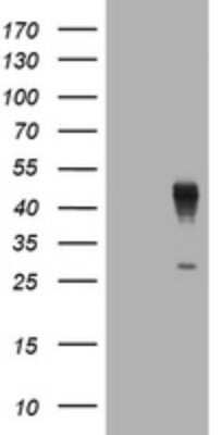 Western Blot: Layilin Antibody (OTI4D3) - Azide and BSA Free [NBP2-72403] - Analysis of HEK293T cells were transfected with the pCMV6-ENTRY control (Left lane) or pCMV6-ENTRY Layilin.