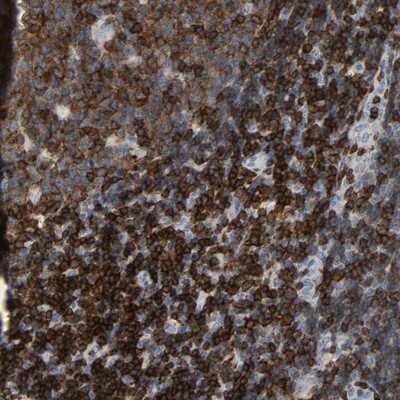 Immunohistochemistry-Paraffin: Lck Antibody [NBP1-85804] - Staining of human lymph node shows high expression.