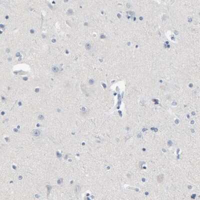 Immunohistochemistry-Paraffin: Lck Antibody [NBP1-85804] - Staining of human cerebral cortex shows low expression as expected.