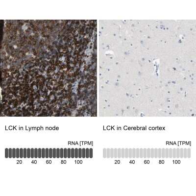 Immunohistochemistry-Paraffin: Lck Antibody [NBP1-85804] - Staining in human lymph node and cerebral cortex tissues using anti-LCK antibody. Corresponding LCK RNA-seq data are presented for the same tissues.