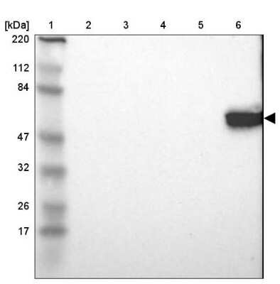 <b>Orthogonal Strategies Validation. </b>Western Blot: Lck Antibody [NBP1-85804] - Lane 1: Marker  [kDa] 220, 112, 84, 47, 32, 26, 17.  Lane 2: Human cell line RT-4.  Lane 3: Human cell line U-251MG sp.  Lane 4: Human plasma (IgG/HSA depleted).  Lane 5: Human liver tissue.  Lane 6: Human tonsil tissue