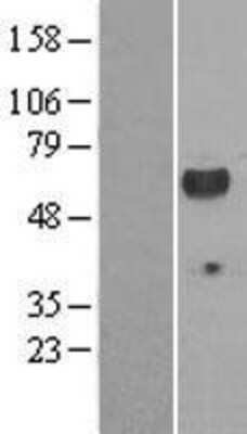 Western Blot: Lck Overexpression Lysate (Adult Normal) [NBP2-08352] Left-Empty vector transfected control cell lysate (HEK293 cell lysate); Right -Over-expression Lysate for Lck.