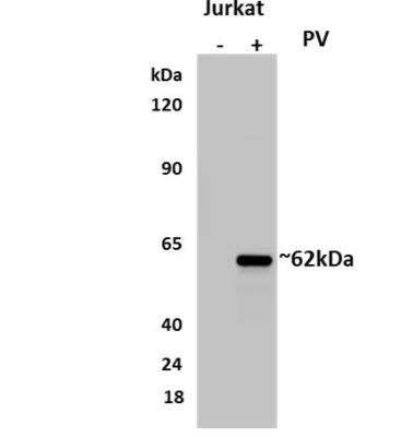 Western Blot: Lck [p Tyr394] Antibody (MM0795-71W27) [NBP2-36789]