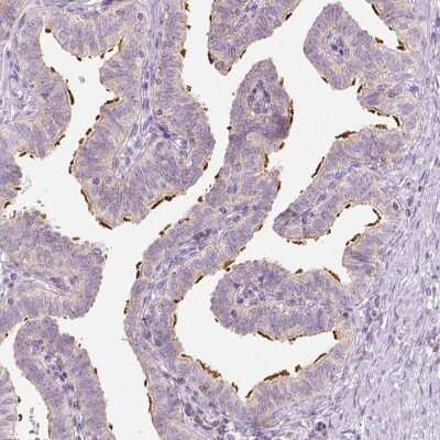 Immunohistochemistry-Paraffin Lebercilin Antibody