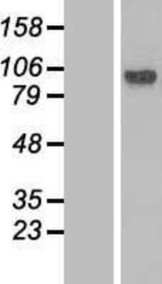 Western Blot: Lebercilin Overexpression Lysate (Adult Normal) [NBL1-12455] Left-Empty vector transfected control cell lysate (HEK293 cell lysate); Right -Over-expression Lysate for Lebercilin.