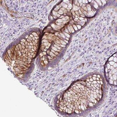 Immunohistochemistry: Lefty-1 Antibody [NBP2-46832] - Staining of human rectum shows moderate positivity in glandular cells.