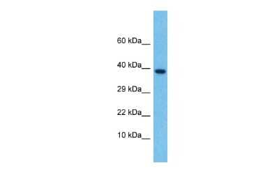 Western Blot: Lefty-2 Antibody [NBP2-86700] - Host: Rabbit. Target Name: LEFTY2. Sample Type: Thymus Tumor lysates. Antibody Dilution: 1.0ug/ml