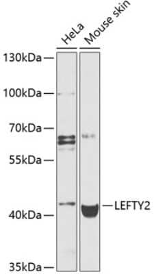 Western Blot: Lefty-2 Antibody [NBP3-03764] - Analysis of extracts of various cell lines, using Lefty-2 antibody at 1:1000 dilution. Secondary antibody: HRP Goat Anti-Rabbit IgG (H+L) at 1:10000 dilution. Lysates/proteins: 25ug per lane. Blocking buffer: 3% nonfat dry milk in TBST. Detection: ECL Basic Kit