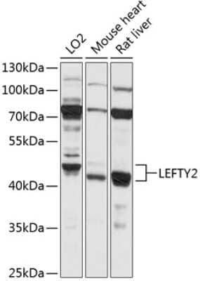 Western Blot: Lefty-2 Antibody [NBP3-03765] - Analysis of extracts of various cell lines, using Lefty-2 antibody at 1:1000 dilution. Secondary antibody: HRP Goat Anti-Rabbit IgG (H+L) at 1:10000 dilution. Lysates/proteins: 25ug per lane. Blocking buffer: 3% nonfat dry milk in TBST. Detection: ECL Basic Kit