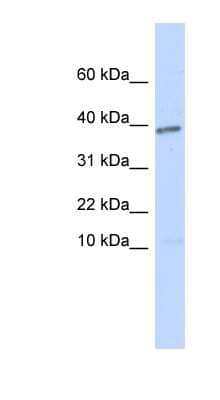 Western Blot: Lefty-1 Antibody [NBP1-59323] - Transfected 293T cell lysate, concentration 0.2-1 ug/ml.