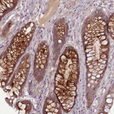 Immunohistochemistry-Paraffin: Lefty-1 Antibody [NBP2-48883] - Staining of human rectum shows strong positivity in glandular cells.