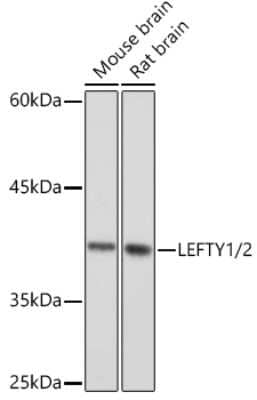 Western Blot: Lefty1/2 Antibody (2Y10P2) [NBP3-16118] - Western blot analysis of extracts of various cell lines, using Lefty1/2 Rabbit mAb (NBP3-16118) at 1:1000 dilution. Secondary antibody: HRP Goat Anti-Rabbit IgG (H+L) at 1:10000 dilution. Lysates/proteins: 25ug per lane. Blocking buffer: 3% nonfat dry milk in TBST. Detection: ECL Basic Kit. Exposure time: 10s.