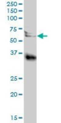 Western Blot: Legumain/Asparaginyl Endopeptidase Antibody [H00005641-B01P] - Analysis of LGMN expression in human kidney.
