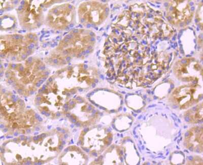 Immunohistochemistry-Paraffin: Leptin R Antibody (JA73-01) [NBP2-66931] - Analysis of paraffin-embedded human kidney tissue using anti-Leptin Receptor antibody. Counter stained with hematoxylin.