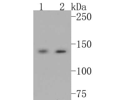 Western Blot: Leptin R Antibody (JA73-01) [NBP2-66931] - Western blot analysis of Leptin R on different lysates. Proteins were transferred to a PVDF membrane and blocked with 5% BSA in PBS for 1 hour at room temperature. The primary antibody (1/500) was used in 5% BSA at room temperature for 2 hours. Goat Anti-Rabbit IgG - HRP Secondary Antibody (HA1001) at 1:5,000 dilution was used for 1 hour at room temperature. Positive control: Lane 1: mouse lung tissue lysate Lane 2: mouse liver tissue lysate