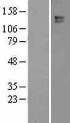 Western Blot: Leptin Receptor Overexpression Lysate (Adult Normal) [NBL1-12490] Left-Empty vector transfected control cell lysate (HEK293 cell lysate); Right -Over-expression Lysate for Leptin Receptor.