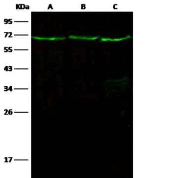 Western Blot: Leukotriene A4 Hydrolase/LTA4H Antibody (201) [NBP2-89374] - Lane A: Hela Whole Cell Lysate Lane B: A549 Whole Cell Lysate Lane C: 293T Whole Cell Lysate Lysates/proteins at 30 ug per lane. Secondary Goat Anti-Rabbit IgG H&L (Dylight800) at 1/10000 dilution. Developed using the Odyssey technique. Performed under reducing conditions. Predicted band size:69 kDa Observed band size:69 kDa