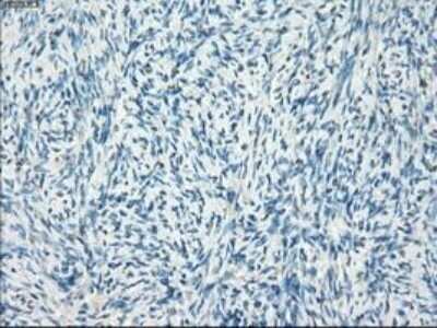 Immunohistochemistry: Leukotriene A4 Hydrolase/LTA4H Antibody (OTI1E9) - Azide and BSA Free [NBP2-71189] - Staining of paraffin-embedded endometrium tissue using anti-Leukotriene A4 hydrolase mouse monoclonal antibody.