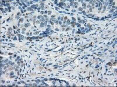 Immunohistochemistry: Leukotriene A4 Hydrolase/LTA4H Antibody (OTI1E9) - Azide and BSA Free [NBP2-71189] - Staining of paraffin-embedded Ovary tissue using anti-Leukotriene A4 hydrolase mouse monoclonal antibody.