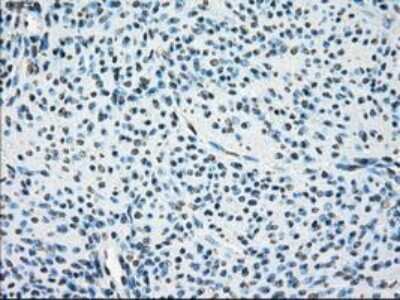 Immunohistochemistry-Paraffin: Leukotriene A4 Hydrolase/LTA4H Antibody (OTI1E9) [NBP1-47829] - Staining of paraffin-embedded prostate tissue using anti-Leukotriene A4 hydrolase mouse monoclonal antibody.