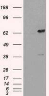 Western Blot: Leukotriene A4 Hydrolase/LTA4H Antibody (OTI1E9) [NBP1-47829] - HEK293T cells were transfected with the pCMV6-ENTRY control (Left lane) or pCMV6-ENTRY Leukotriene A4 hydrolase(Right lane) cDNA for 48 hrs and lysed. Equivalent amounts of cell lysates (5 ug per lane) were separated by SDS-PAGE and immunoblotted with anti-Leukotriene A4 hydrolase.