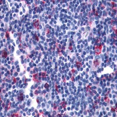 Immunohistochemistry-Paraffin: Leukotriene B4 Receptor 2 Antibody [NLS2102] - Analysis of anti-LTB4R2 / BLT2 antibody with tonsil at 4 ug/ml.