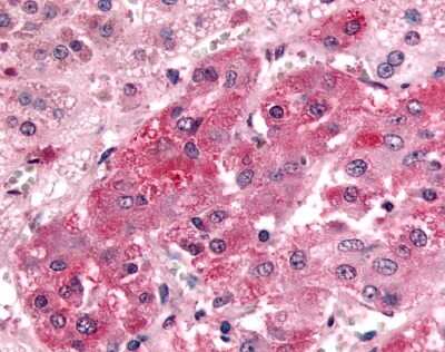 Immunohistochemistry-Paraffin: Leukotriene B4 Receptor 2 Antibody [NLS4946] - Analysis of anti-GPR108 antibody with human adrenal, medulla.