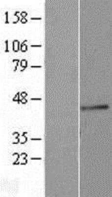 Western Blot: Lewis A Blood Group Antigen Overexpression Lysate (Native) [NBP2-11431] - Left-Empty vector transfected control cell lysate (HEK293 cell lysate); Right -Over-expression Lysate for Blood Group Lewis A.