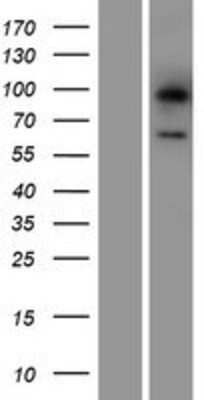 Western Blot Lgi3 Overexpression Lysate