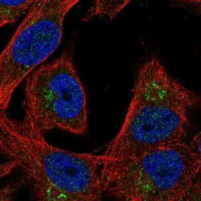 Immunocytochemistry/Immunofluorescence: Lgi4 Antibody [NBP2-30423] - Staining of human cell line SK-MEL-30 shows localization to the Golgi apparatus.