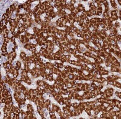 Immunohistochemistry: Lgi4 Antibody [NBP2-30545] - Staining of human liver shows strong cytoplasmic positivity in hepatocytes.