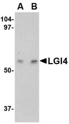 Western Blot: Lgi4 Antibody [NBP1-76380] - Human brain tissue lysate with LGI4 antibody at (A) 1 and (B) 2 ug/mL.