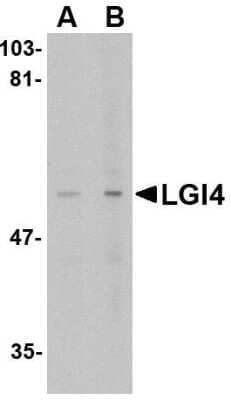 Western Blot: Lgi4 Antibody [NBP1-76381] - Rat brain tissue lysate with LGI4 antibody at (A) 1 and (B) 2 ug/mL.