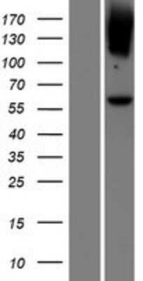 Western Blot: Lgi4 Overexpression Lysate (Adult Normal) [NBP2-05578] Left-Empty vector transfected control cell lysate (HEK293 cell lysate); Right -Over-expression Lysate for Lgi4.