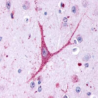 Immunohistochemistry-Paraffin: Lgr4/GPR48 Antibody [NLS1631] - Analysis of anti-GPR48 / LGR4 antibody with human brain neurons.