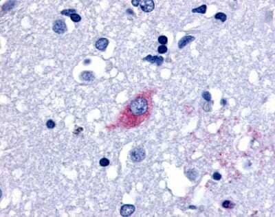 Immunohistochemistry-Paraffin: Lgr4/GPR48 Antibody [NLS1633] - Analysis of anti-LGR4 antibody with human brain, neurons and glia at 4 ug/ml.