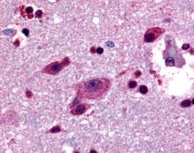 Immunohistochemistry-Paraffin: Lgr4/GPR48 Antibody [NLS3560] - Analysis of anti-LGR4 antibody with human brain, cortex.