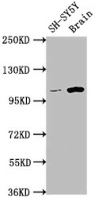 Western Blot: Lgr5/GPR49 Antibody (4H8) [NBP3-15237] - Positive WB detected in: SH-SY5Y whole cell lysate, Rat brain tissue. All lanes: Lgr5/GPR49 antibody at 1:1500. Secondary: Goat polyclonal to rabbit IgG at 1/50000 dilution. Predicted band size: 100, 98, 93 KDa. Observed band size: 100 KDa.