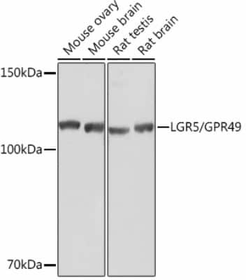 Western Blot: Lgr5/GPR49 Antibody (9J9B8) [NBP3-15445] - Western blot analysis of extracts of various cell lines, using Lgr5/GPR49 Rabbit mAb (NBP3-15445) at 1:1000 dilution. Secondary antibody: HRP Goat Anti-Rabbit IgG (H+L) at 1:10000 dilution. Lysates/proteins: 25ug per lane. Blocking buffer: 3% nonfat dry milk in TBST. Detection: ECL Basic Kit. Exposure time: 1s.